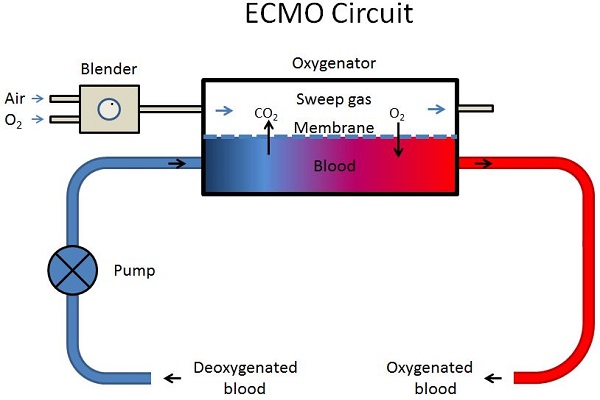 ECMO circuit